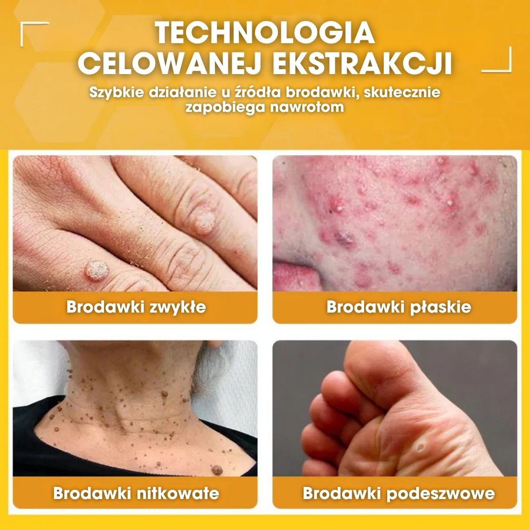 DermaBee™ – Silny krem z jadem pszczelim - 1+1 GRATIS