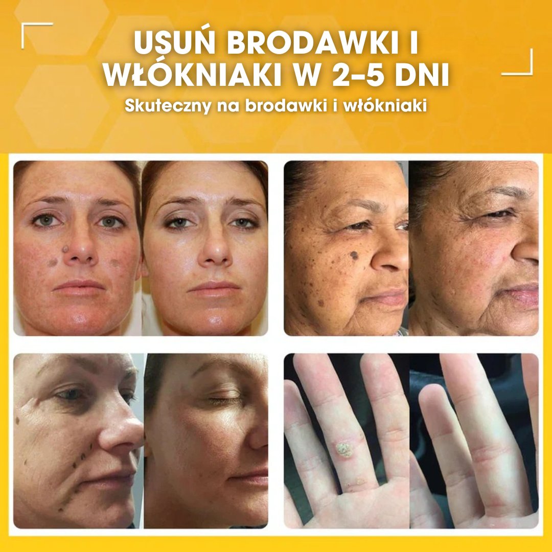 DermaBee™ – Silny krem z jadem pszczelim - 1+1 GRATIS