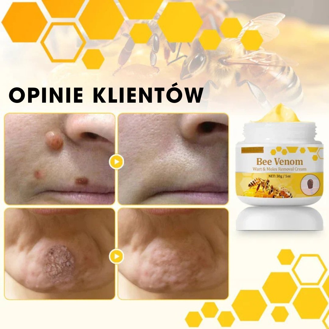 DermaBee™ – Silny krem z jadem pszczelim - 1+1 GRATIS