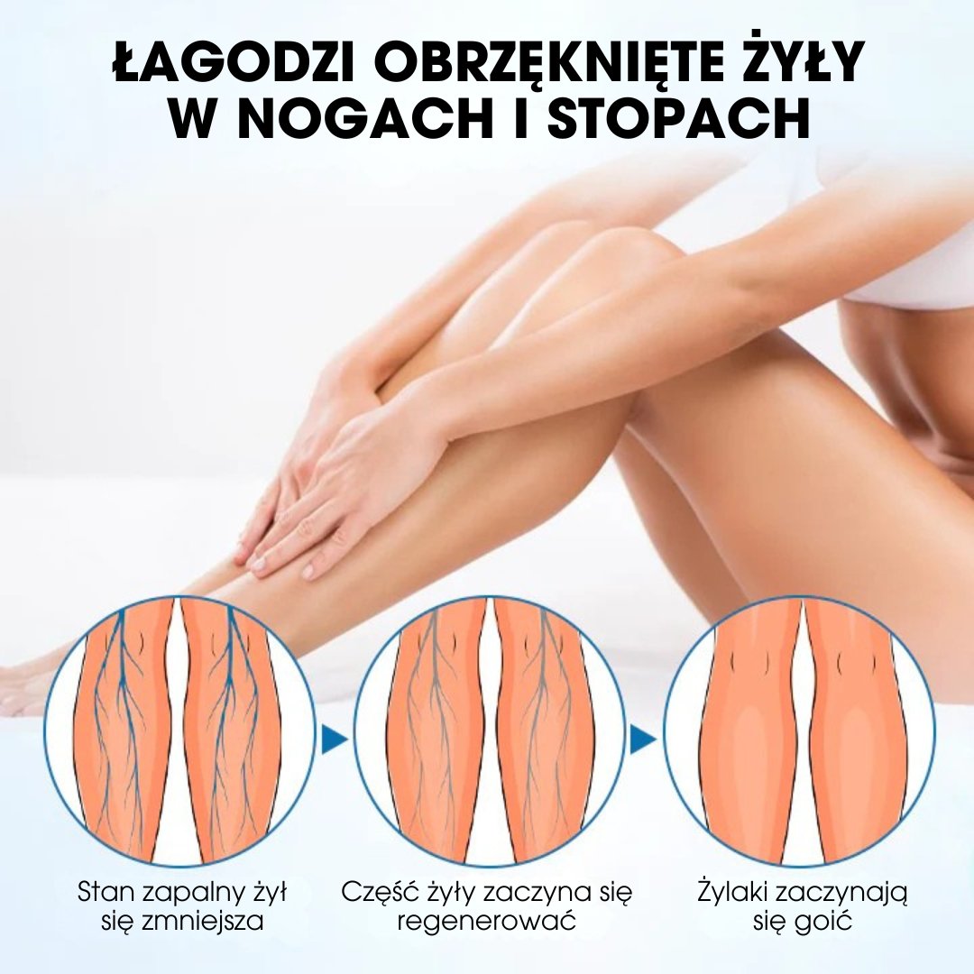 Timilk® VeinGuard – Klinicznie potwierdzona skuteczność w redukcji żylaków