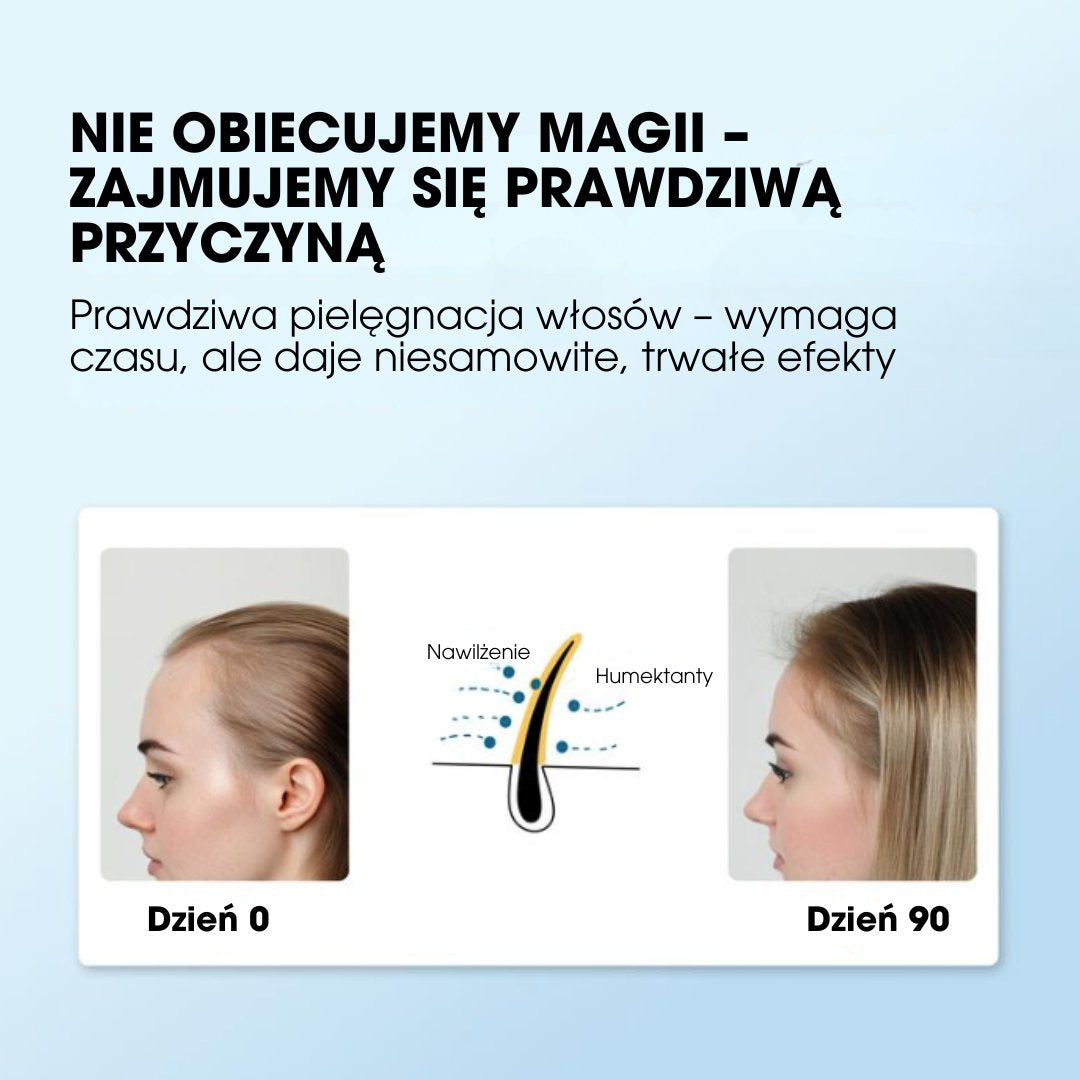 RootIgnite™ – Roll-on na natychmiastowy porost włosów - 1+1 GRATIS