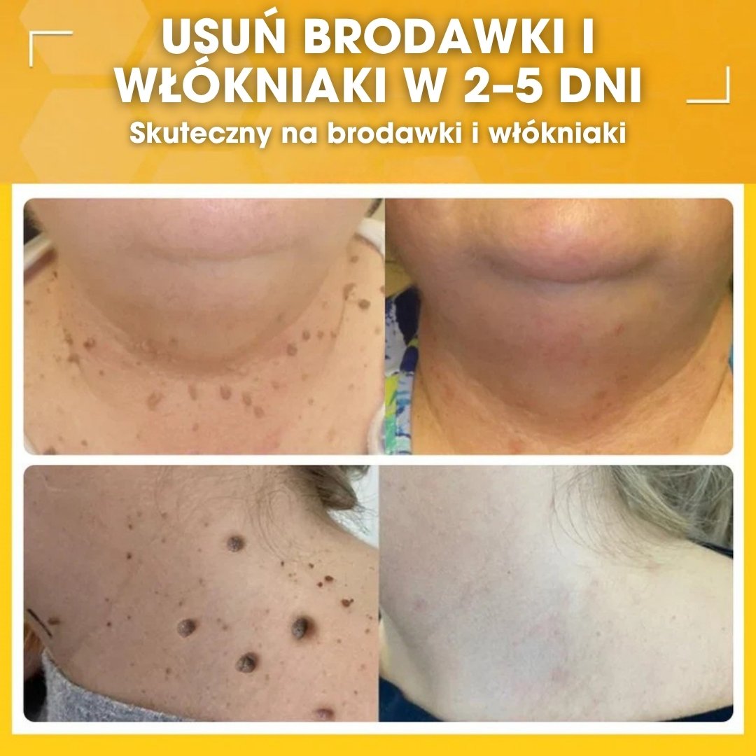 DermaBee™ – Silny krem z jadem pszczelim - 1+1 GRATIS