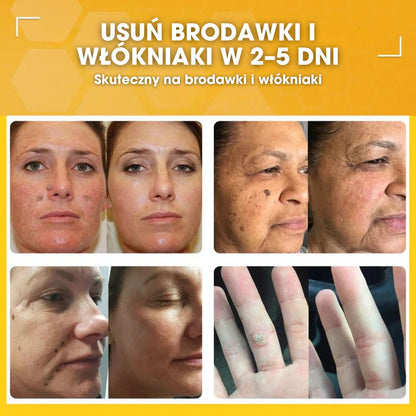 DermaBee™ – Silny krem z jadem pszczelim - 1+1 GRATIS