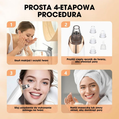 PorePro™ – 6-w-1 oczyszczacz porów z regulacją siły ssania i zestawem do wyciskania