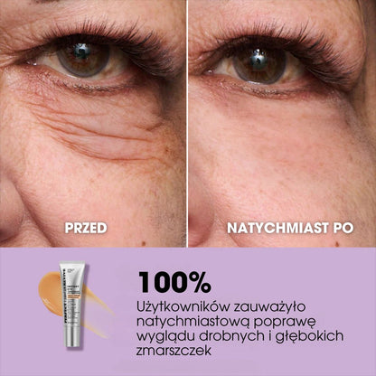 EyeRevive™ – Natychmiastowy lifting okolic oczu + DARMOWA szczoteczka