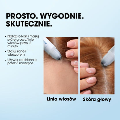 RootIgnite™ – Roll-on na natychmiastowy porost włosów - 1+1 GRATIS